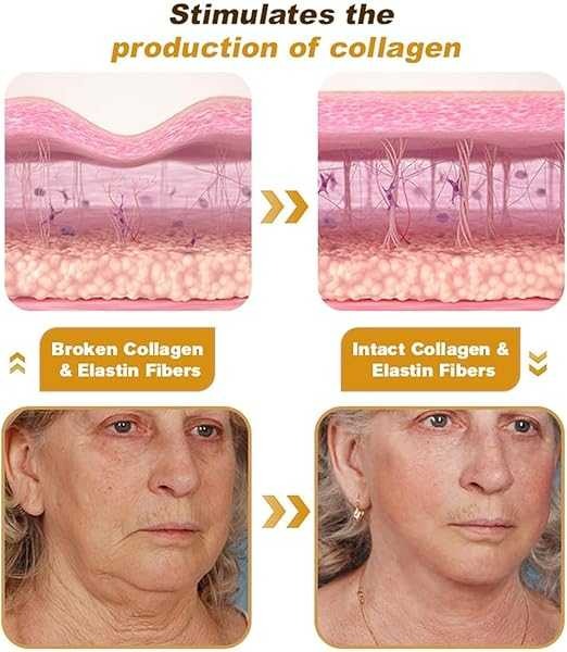 Barqon Botox Bee Venom Cream